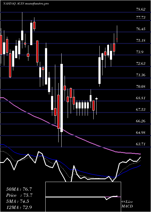 Daily chart AgilysysInc