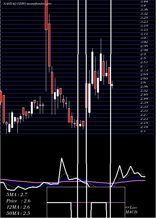 Daily chart VenusConcept