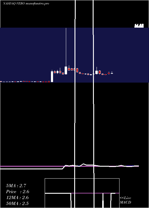 weekly chart VenusConcept